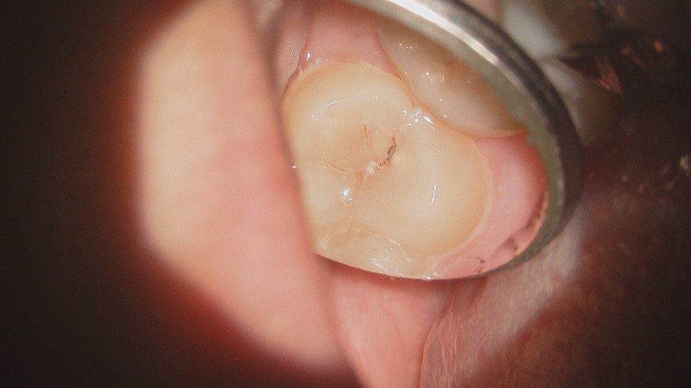 Hatch Dental Clinicのマイクロスコープ