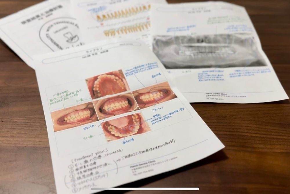 精密検査に基づく治療計画資料