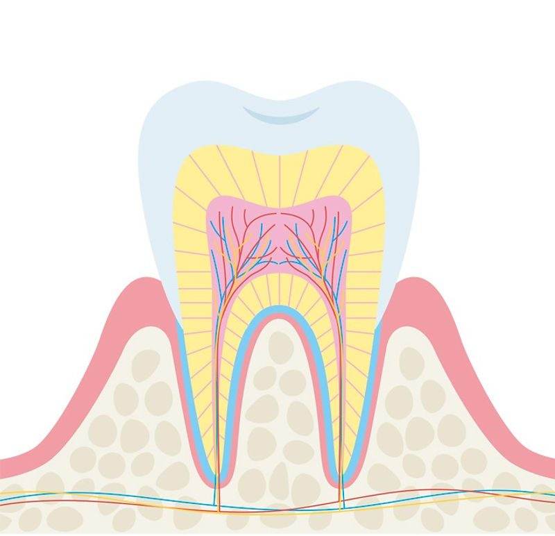 Hatch Dental Clinicでの根管・歯髄の問題イメージ