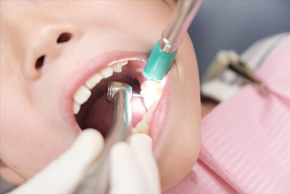 Hatch Dental Clinicでの痛みを抑え歯を削るイメージ
